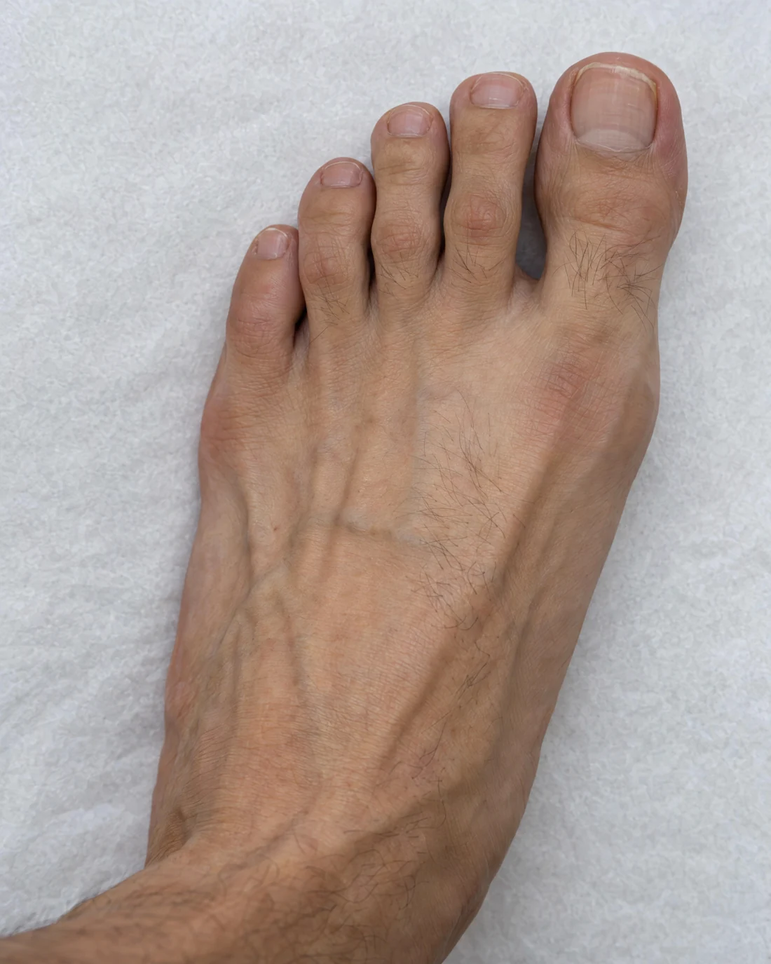 Illustration photographique du dessus du pied et de la base des orteils