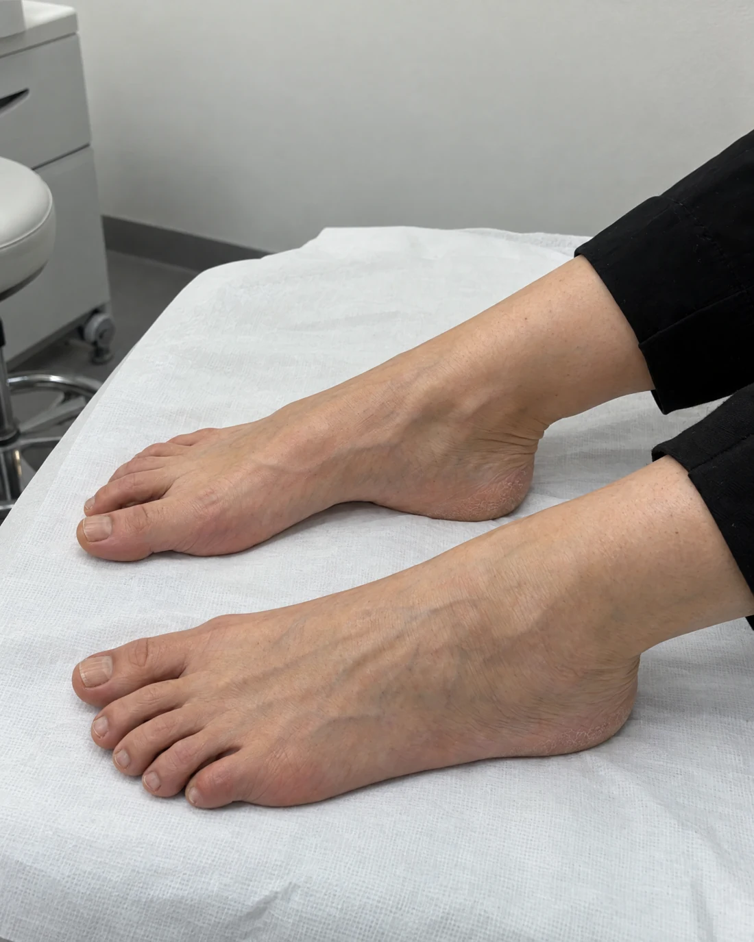Illustration de la zone des pieds et des chevilles sur une table de soin